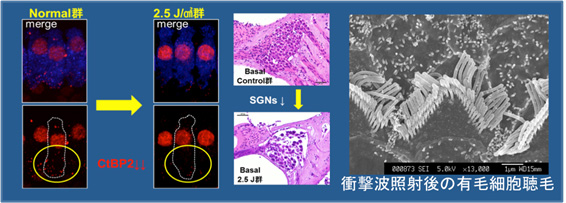 衝撃波照射後の有毛細胞聴毛