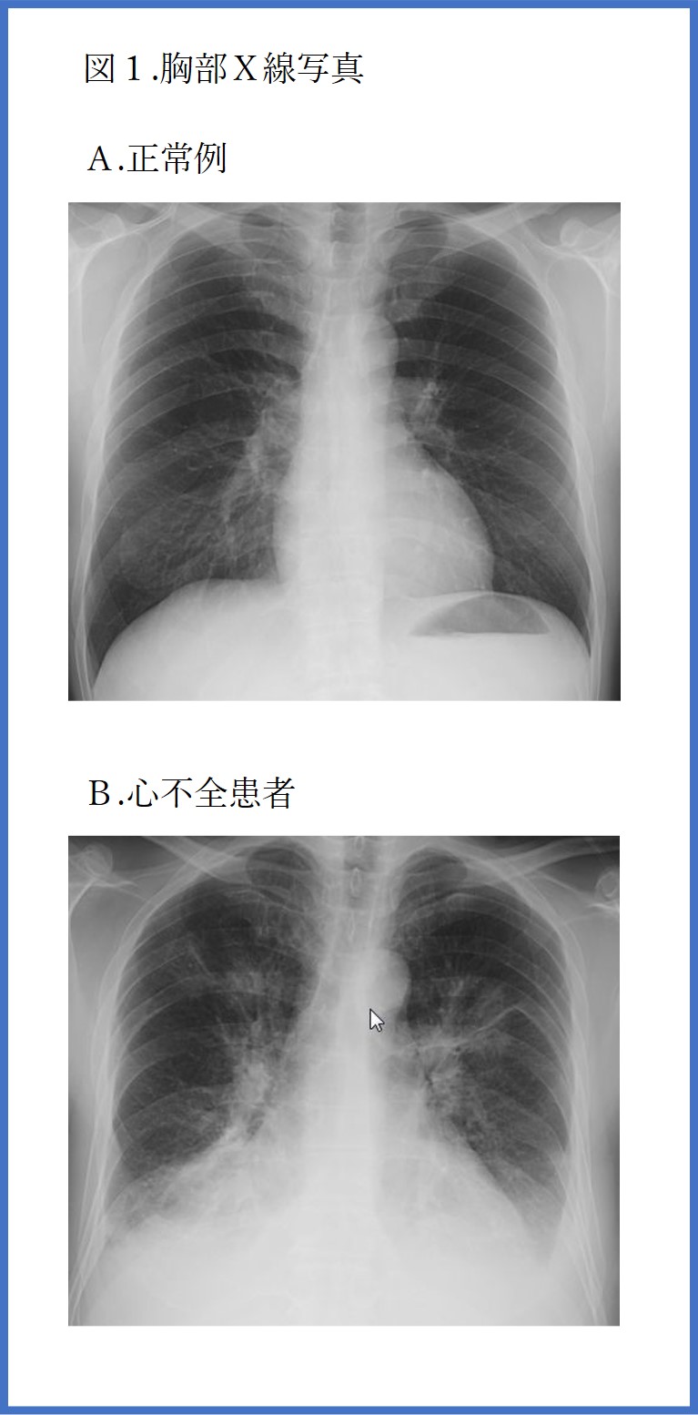 図１胸部Ｘ線写真
