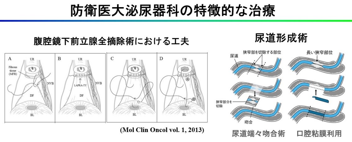 防衛医大泌尿器科の特徴的な治療