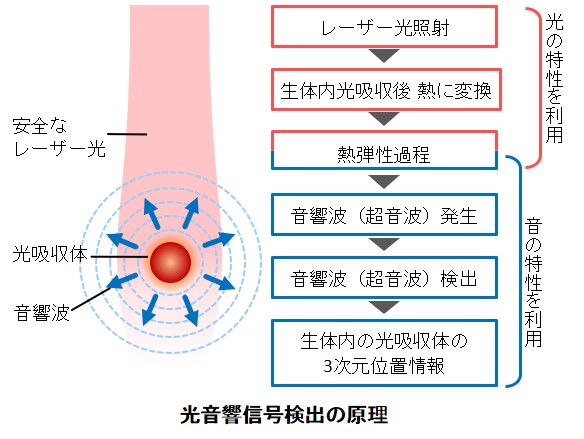 光音響信号検出の原理