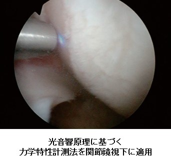 光音響原理に基づく力学特性計測法を関節鏡視下に適用