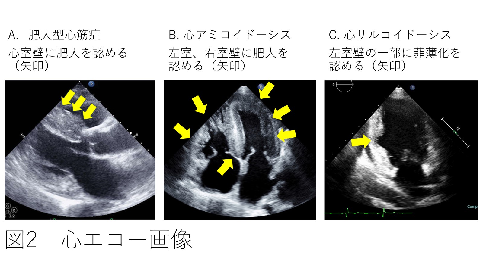 図２心エコー写真